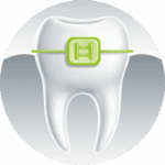 Ortodontia e implantes