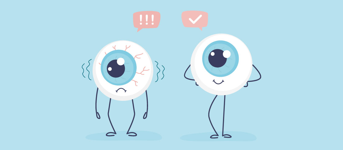 A importância de prevenir e gerir o Síndrome de Disfunção Lacrimal na conjuntivite alérgica – e como enfrentar este problema