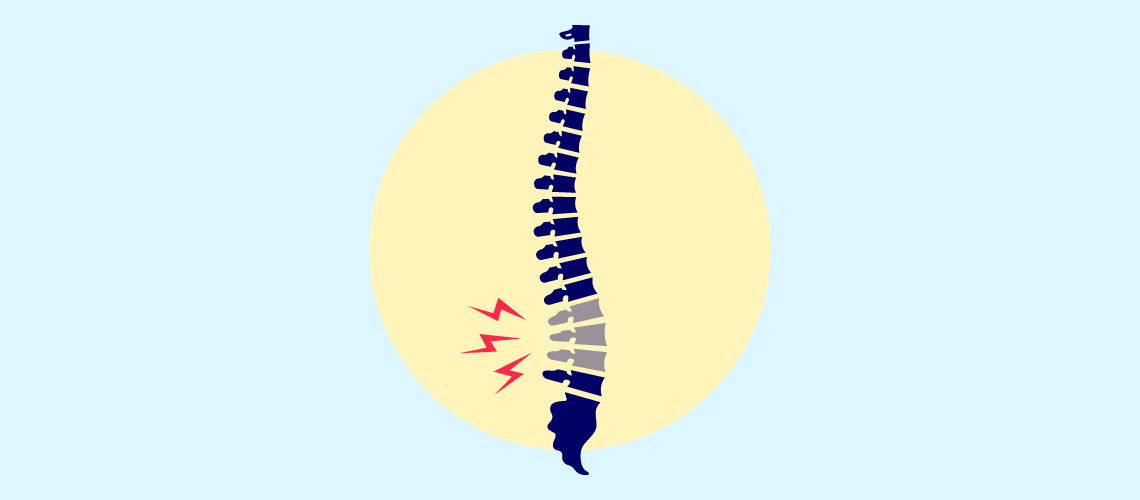 Papel dos miorrelaxantes e do metocarbamol na lombalgia