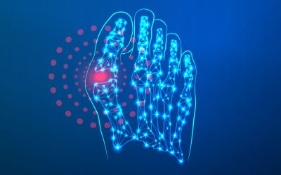 alopurinol-gota-cronica-1