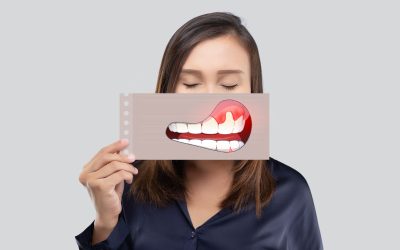 diabetes-doenca-periodontal-1