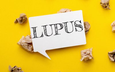 lupus-eritematoso-sistemico-1